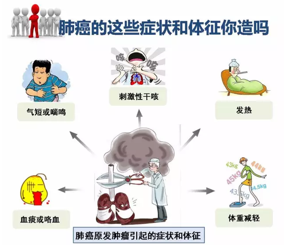 福州治疗肺癌的中医科哪个好